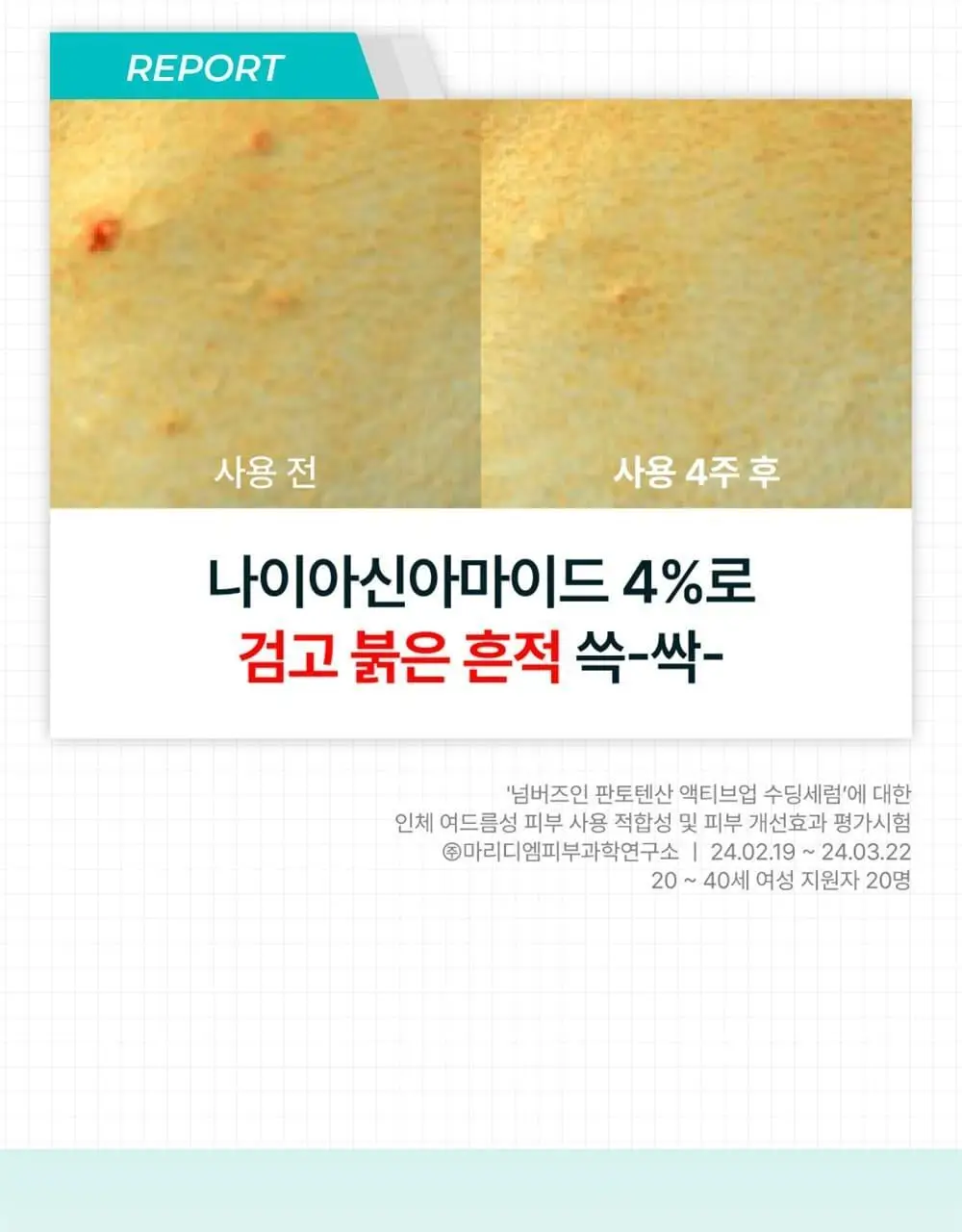 [대용량+크림증정] 넘버즈인 1번 판토텐산 수딩세럼 80ml 기획 (+크림 15ml) 상세페이지 26